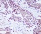 Anti-PTEN Rabbit Monoclonal Antibody